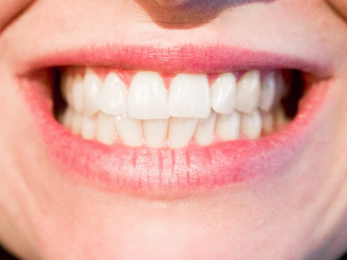 Obecna technika używana w salonach stomatologii estetycznej być może sprawić, że odzyskamy śliczny uśmiech.
